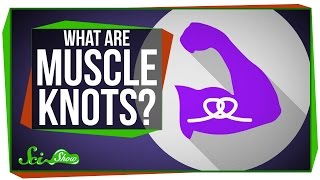 What Are Muscle Knots? What Are Muscle Knots?
