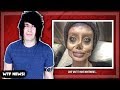 WOMAN'S PLASTIC SURGERY GOES HORRIBLY WRONG!! [WTF NEWS!]