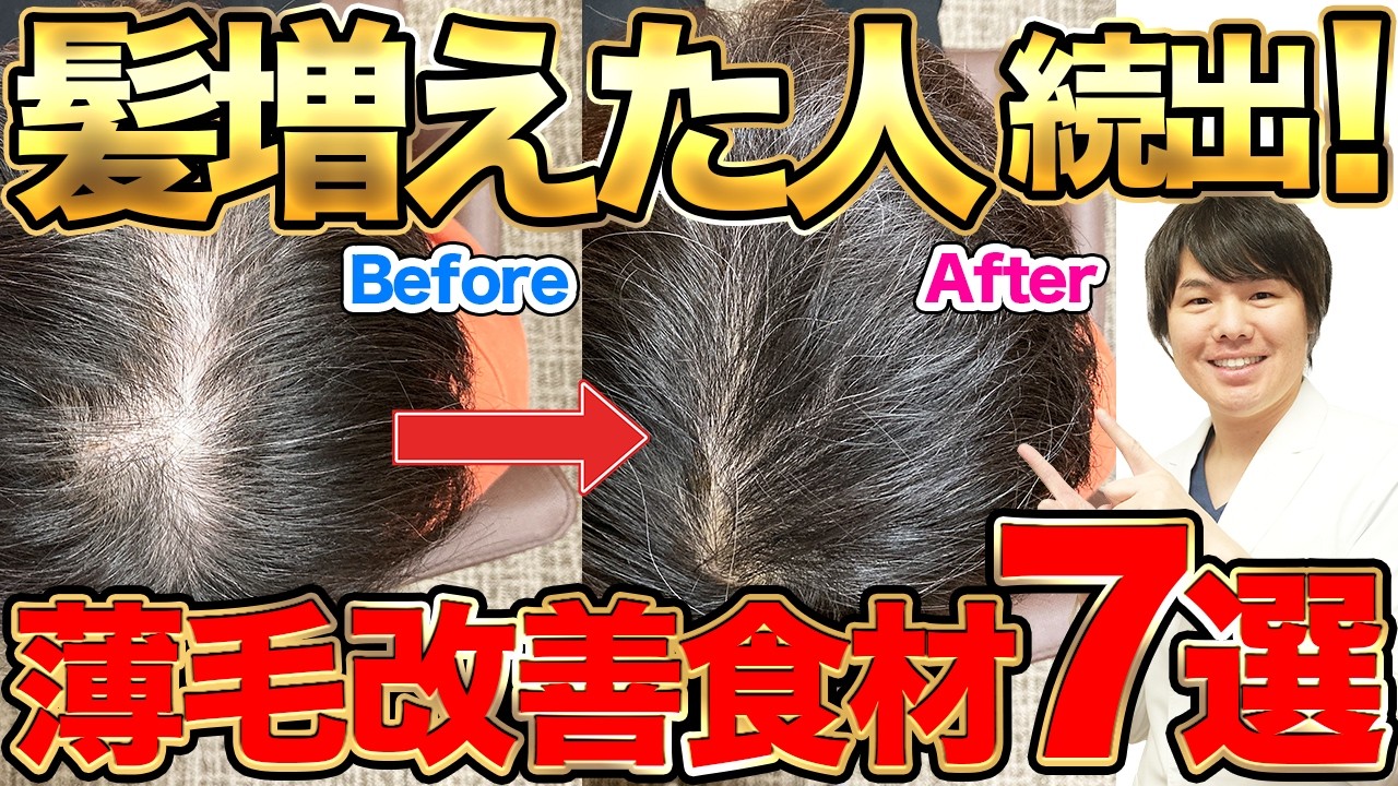 【衝撃】科学が認めた“髪の毛が増える”最強食材TOP7！薄毛改善＆発毛が加速する秘密を大公開！