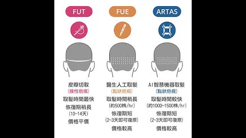 【#植髮 原來如此】FUT、FUE、ARTAS 植髮手術比較 - 天天要聞