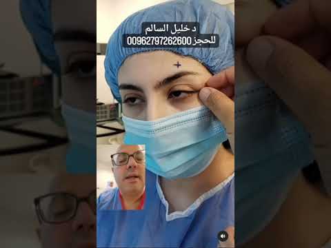 إزاله ورم حميد من جفن العين