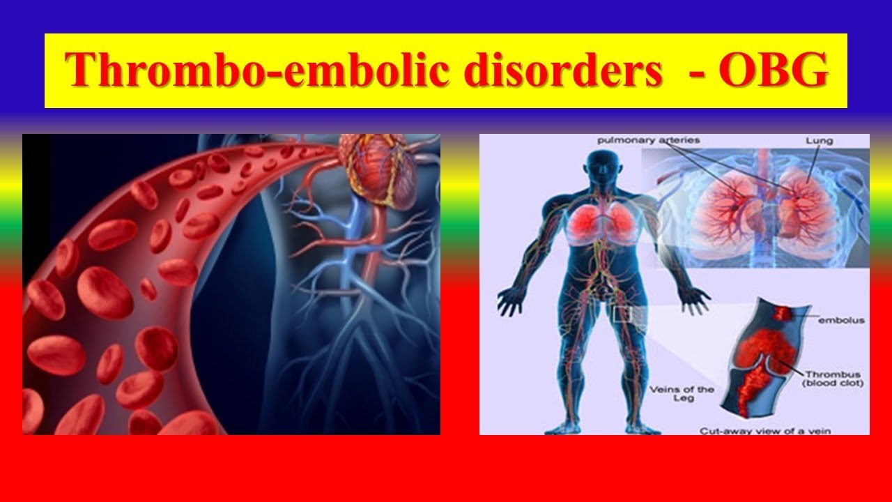 THROMBOEMBOLIC DISORDERS Define , Puerperium , management , care of