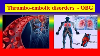 THROMBOEMBOLIC DISORDERS - Define  , Puerperium , management , care of mothers - OBG