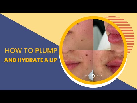 HOW TO PLUMP AND HYDRATE A LIP WITHOUT A CUPID'S BOW AND MINIMAL VOLUME WHEN SMILING | DR JASON EMER