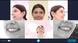 Celebrity RAYFace Acquisition Guide Profile