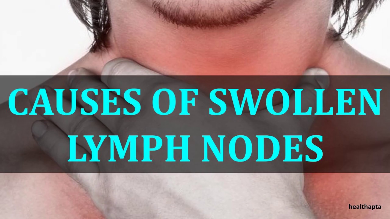 What Causes Swollen Lymph Nodes In Neck