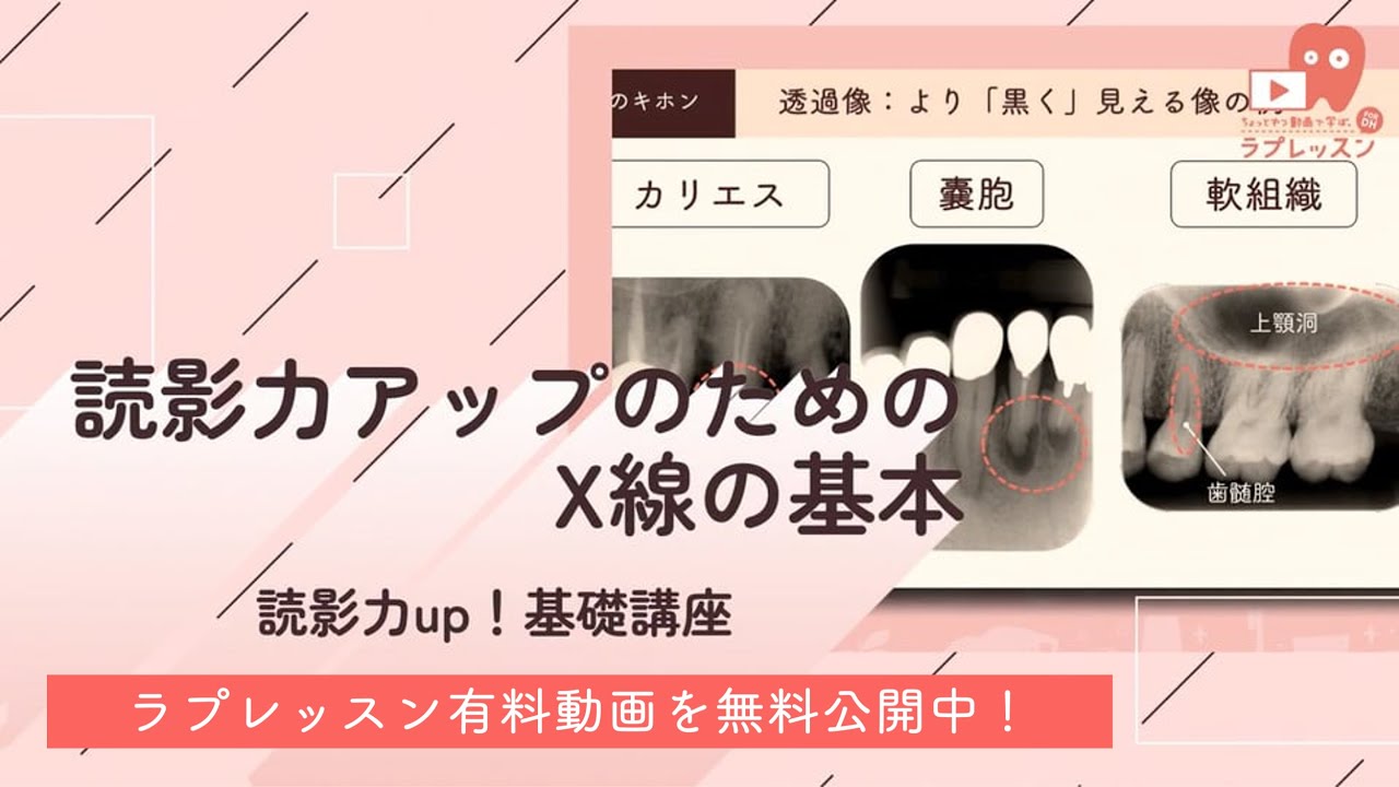読影力up！基礎講座 01.読影力アップのためのX線の基本 （ラプレッスン