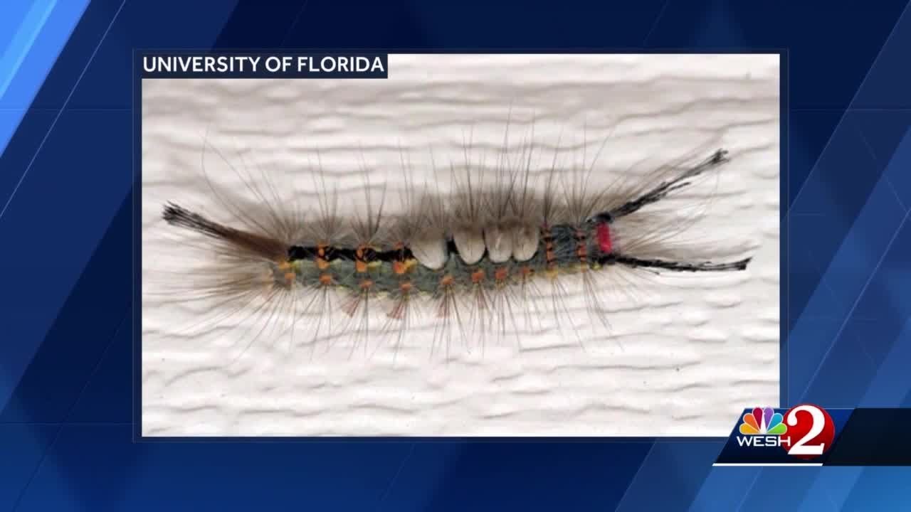 Florida officials warn of fuzzy caterpillars that leave stinging rashes