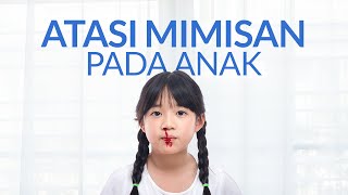 Ketahui Penyebab Mimisan pada Anak dan Cara Menanganinya