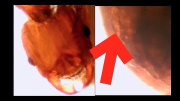 ANT HEART SEEN UNDER MICROSCOPE!!!