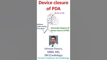 Apparaatsluiting van PDA