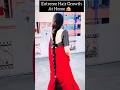 🌎World's Best hair growth serum #viral #ytshorts