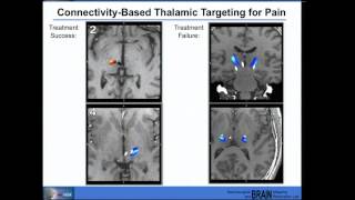 Neural Prosthesis Seminar, Nader Pouratian, MD, PhD
