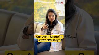 Can Acne Scars Go Away Naturally? | Acne Scars Treatment | Clear Skin Clinic, Pune