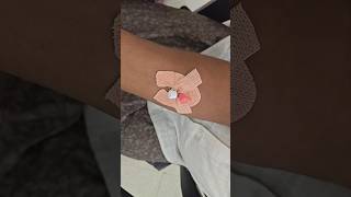 iv cannula shorts#trending#medical#patient#hospital#nurse#doctor#iv cannulation#viral