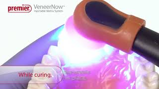 VeneerNow™ Injectable Matrix System - Create An Anterior Composite Crown