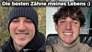 3 Jahre OHNE Zahnpasta (ehrliches Fazit)