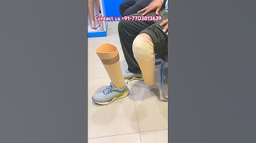 Symes Amputee Carbon Prosthetic Leg user of Bornlife | #prostheticlimb #ossur #artificiallimb #nakli