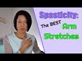 Spasticity: Best Stroke Arm Stretches