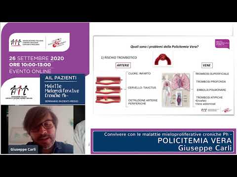 Video: Policitemia Vera: Sintomi, Trattamento, Forme, Fasi, Diagnosi