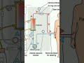 What is dialysis ?