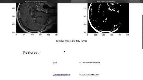 4thJuly2020 Brain Tumor classification by deep learning praveenkumar Team