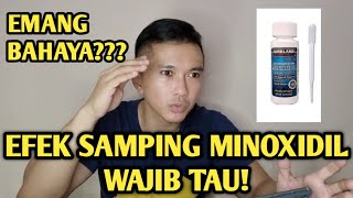 EFEK SAMPING MINOXIDIL. WAJIB TAU DAN WASPADA!