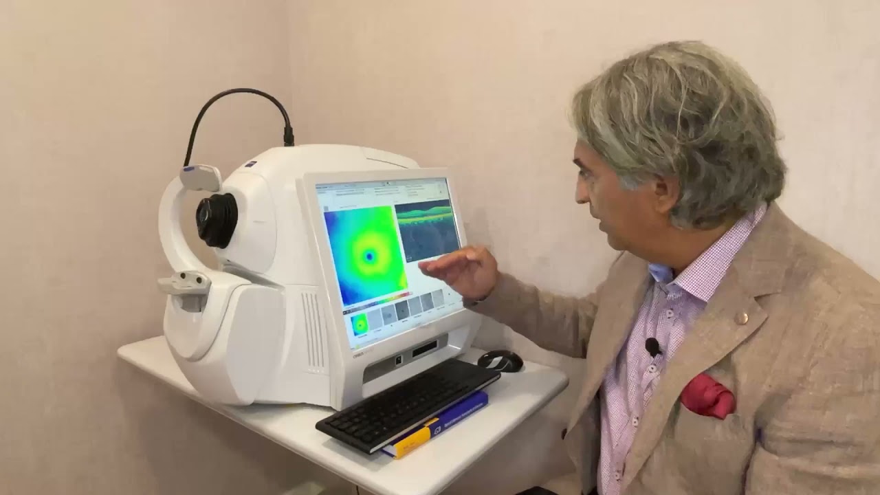 Göz Tomografisi Nedir? - Prof. Dr. Ahmet Akman