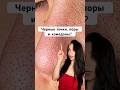 Сыворотка 142054898 и крем 154859673 от этих проблем с кожей #ниацинамид #черныеточки #комедоны