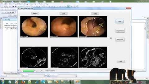 Saliency based Ulcer Detection for Wireless Capsule Endoscopy Diagnosis