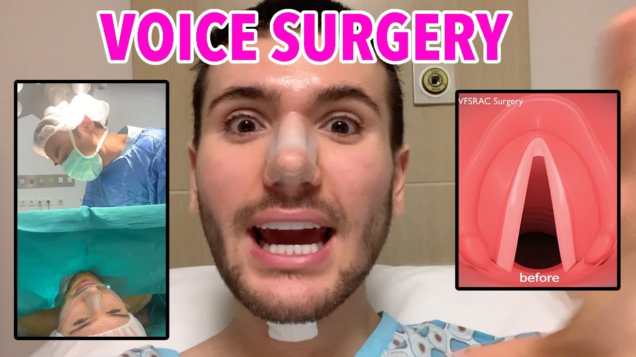 GETTING VOICE MASCULINIZATION SURGERY YouTube