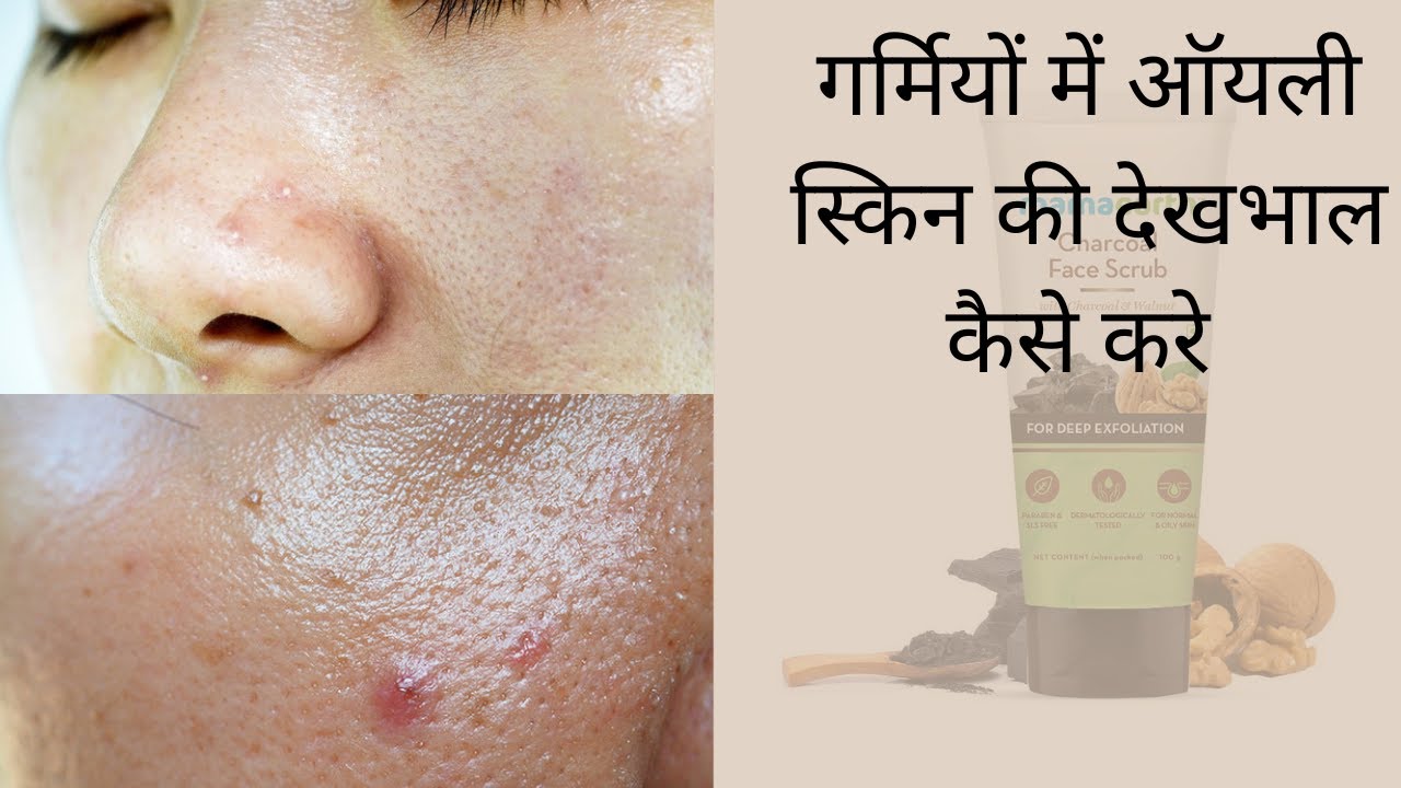 Oily skin care routine in summers.oliy skin care products.oily skin ctm