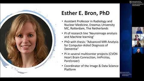 Analysis of neurodevelopment and neurodegeneration on brain imaging using machine learning