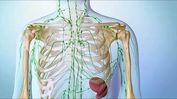 ¿Qué virus causan el linfoma?