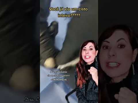 Vídeo: Como remover um cisto em seu rosto: 9 etapas (com fotos)