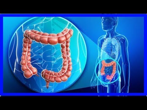 Video: Morbus Crohn diagnostizieren und behandeln – wikiHow