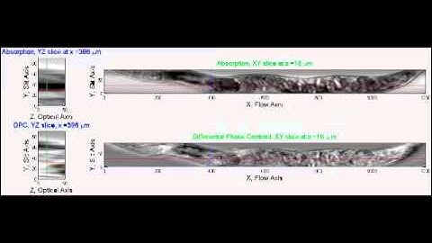 Flow-Scanning Optical Tomography