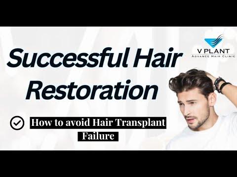 How to avoid Hair Transplant Failure | Get better results | Successful Hair  Restoration - YouTube