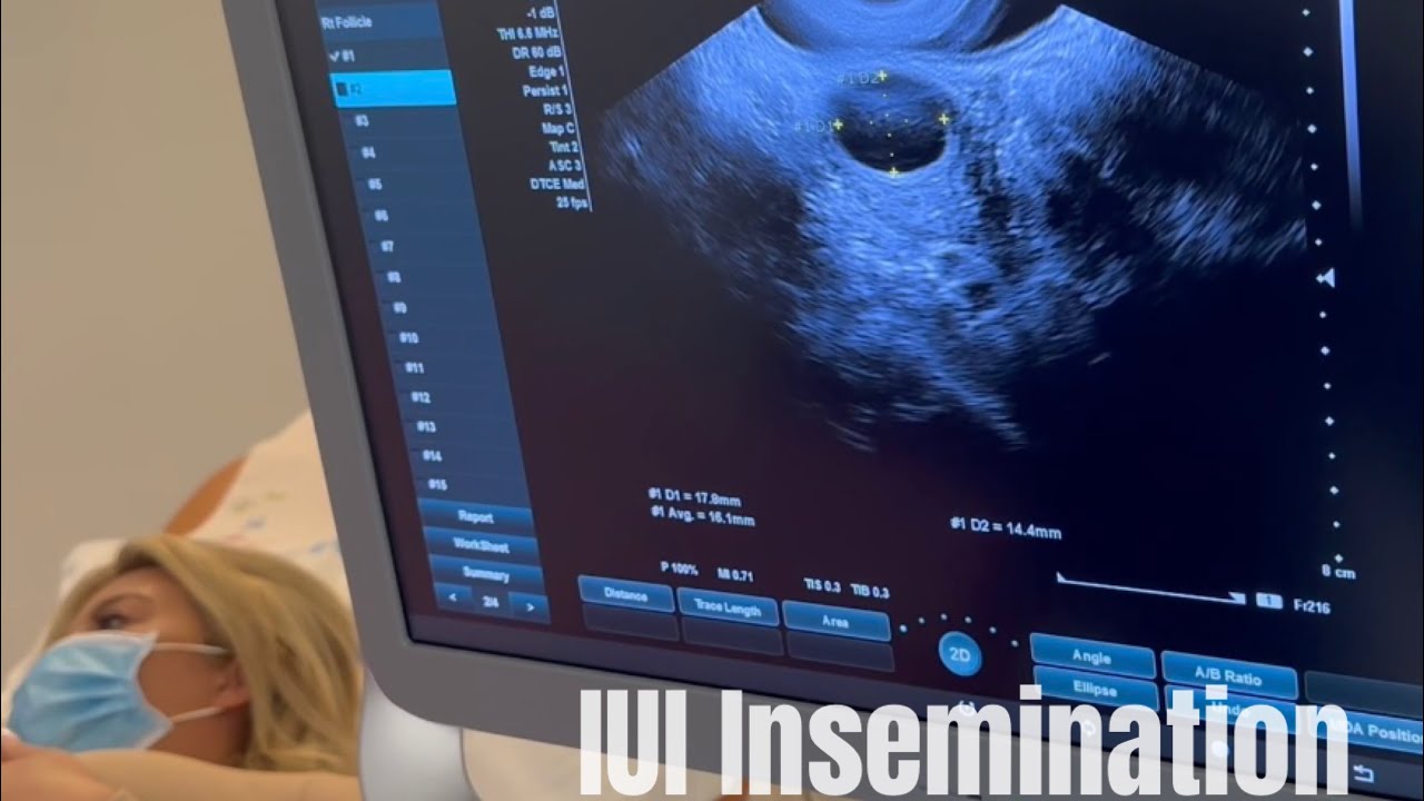 Our Fertility Journey Episode 2 YouTube