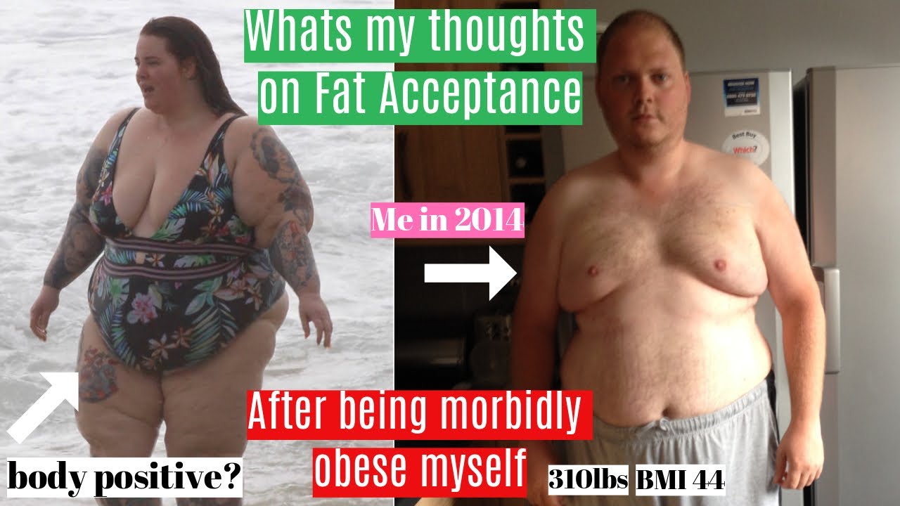 What Do I Think To Body Positivity Fat Acceptance A Currently Obese Persons Thoughts Youtube