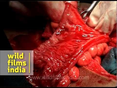 What Surgeons Do Inside The Operation Theatre Youtube