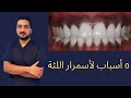 5 Reasons That Lead To Darkening Of The Gums 