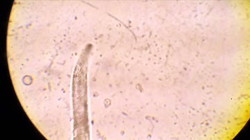 Nematode movement