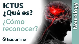 WHAT IS A STROKE AND HOW TO RECOGNIZE IT AND TREAT IT