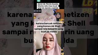 Perkara gigi Melda heboh, kak shel langsung gercep #shellasaukia