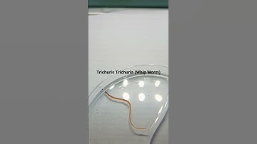 #Trichuris Trichiura (Whipworm) #viralvideo #microscope #trending #mbbs #laboratory