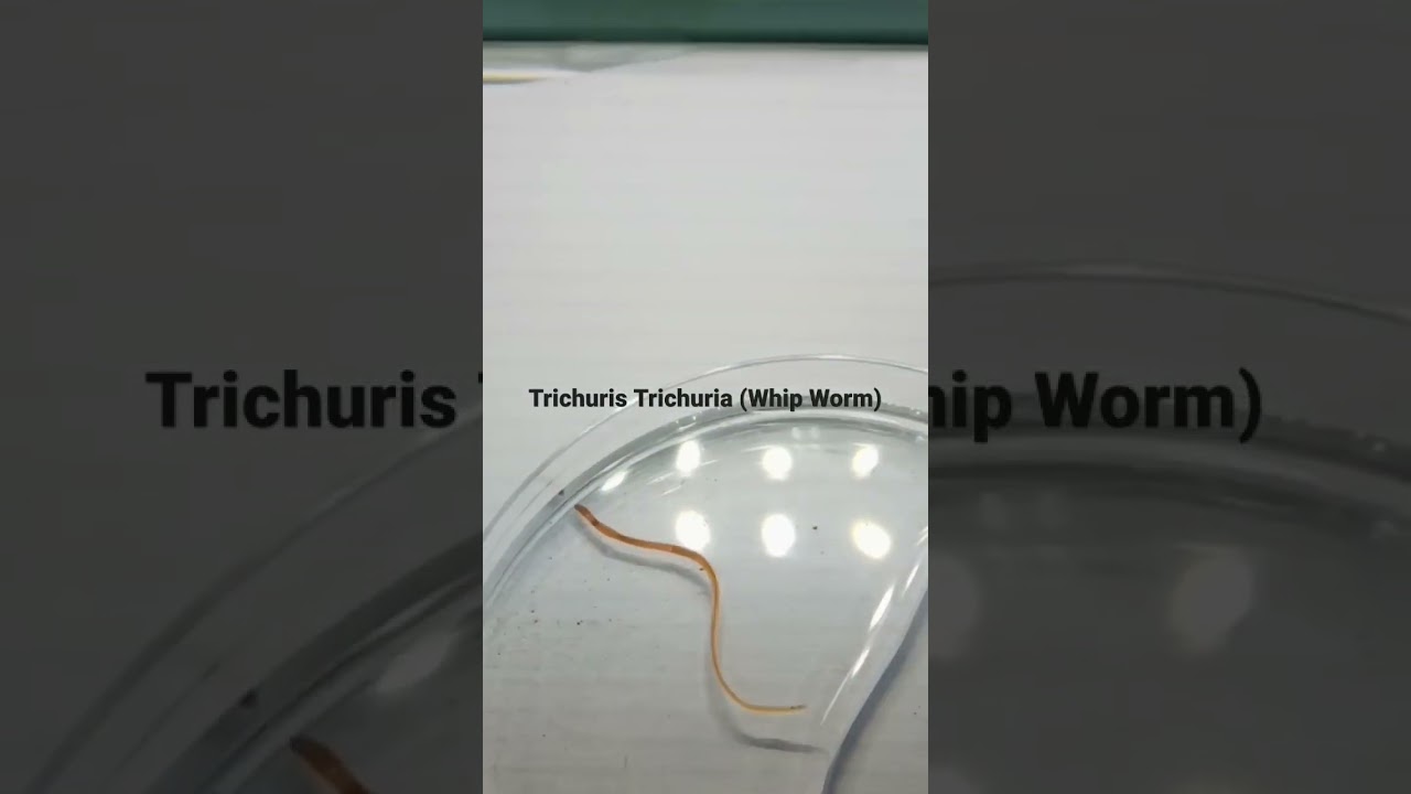 #Trichuris