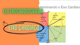 Determinação do Eixo Cardíaco (Eletrocardiograma)