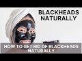 Blackheads Naturally | How To Get Rid of Blackheads Naturally