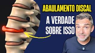 A Verdade Sobre ABAULAMENTO DISCAL que Ninguém Te Conta (Não é o Fim!)